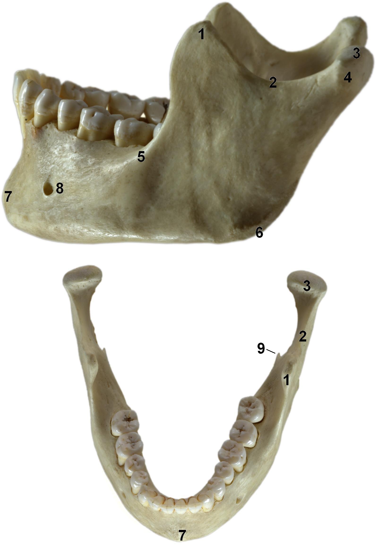 Зуб без кости. Кость челюсти. Нижняя челюсть. Нижняя челюсть кость.